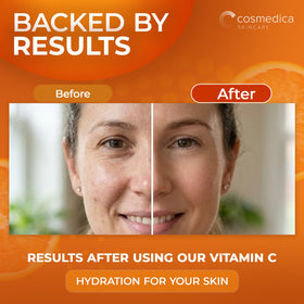 Cosmedica Vitamin C Serum application on cheek close-up shows even tone