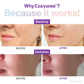 Cosyuree Collagen Spicule Serum micro spicules close-up showing potent delivery.