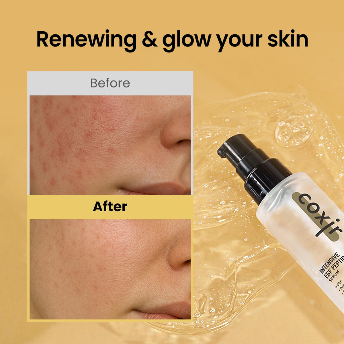 Coxir Intensive EGF Peptides Serum dropper image showing easy application