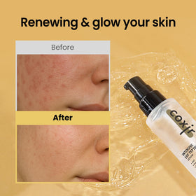 Coxir Intensive EGF Peptides Serum dropper image showing easy application