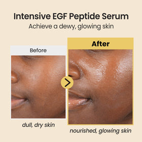 Coxir Intensive EGF Peptides Serum texture close-up with quick absorption