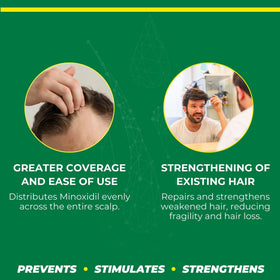 Crece Pelo minoxidil bottle label highlights 5% strength for clear dosing.