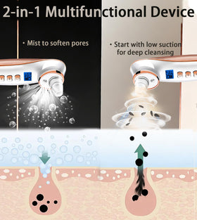 Ctpceept Blackhead Remover Pore Vacuum heads close-up for targeted cleansing.