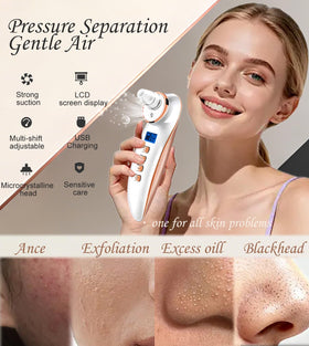Ctpceept Blackhead Remover Pore Vacuum microcrystalline head for gentle exfoliation.
