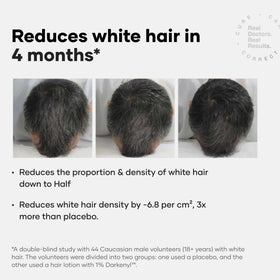 Cureskin Anti Grey Hair Serum head-hair close-up highlighting scalp coverage