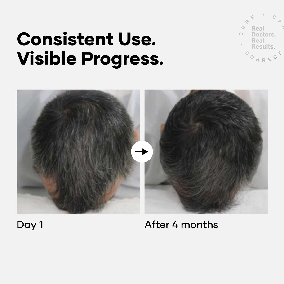 Cureskin Anti Grey Hair Serum packaging box on vanity for easy daily routine.