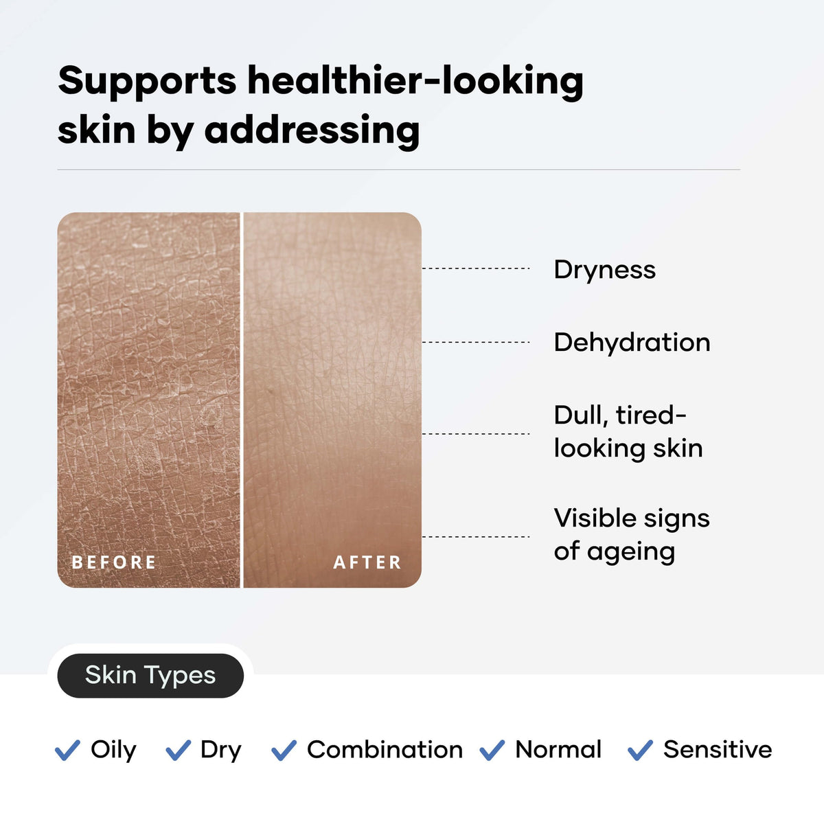 Cureskin hyaluronic acid moisturizer texture shot demonstrates deep hydration.