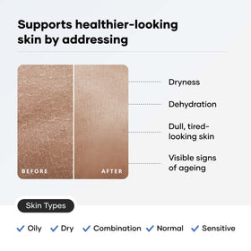 Cureskin hyaluronic acid moisturizer texture shot demonstrates deep hydration.