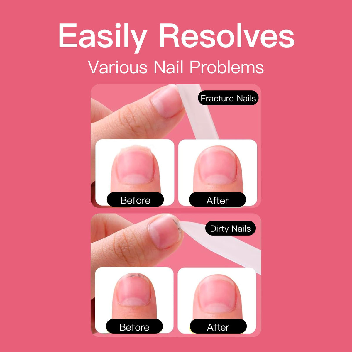 Curvlife remover enables easy removal in 2-3 minutes.