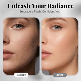 Facial oil from Cutemiss to assist glide during dermaplaning and nourish skin afterward.