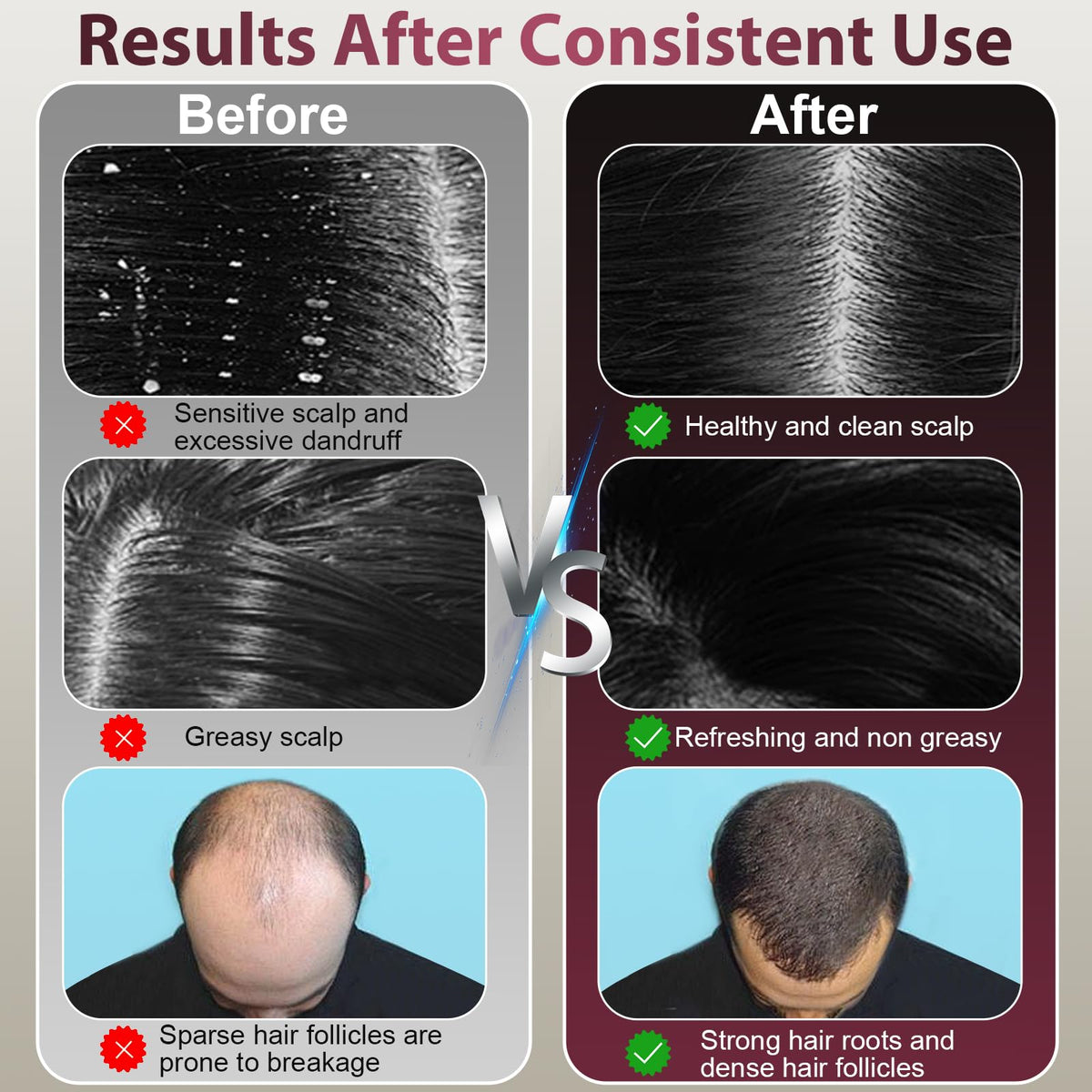 CWTUL Electric Scalp Massager delivers relaxing kneading and tapping for a spa-like routine.