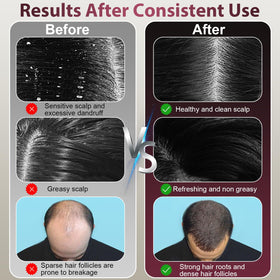 CWTUL Electric Scalp Massager delivers relaxing kneading and tapping for a spa-like routine.