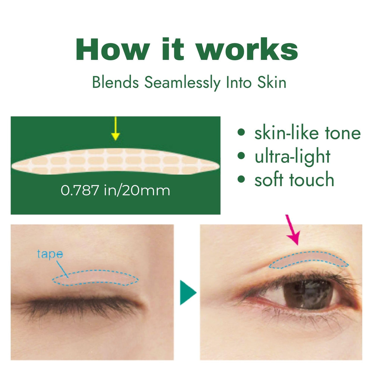 D-UP applicator tool helps precise placement for flawless results.