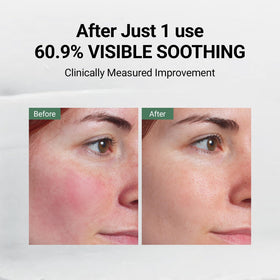 DA EFFECT Niacinamide focus suggests improved tone after skin stress