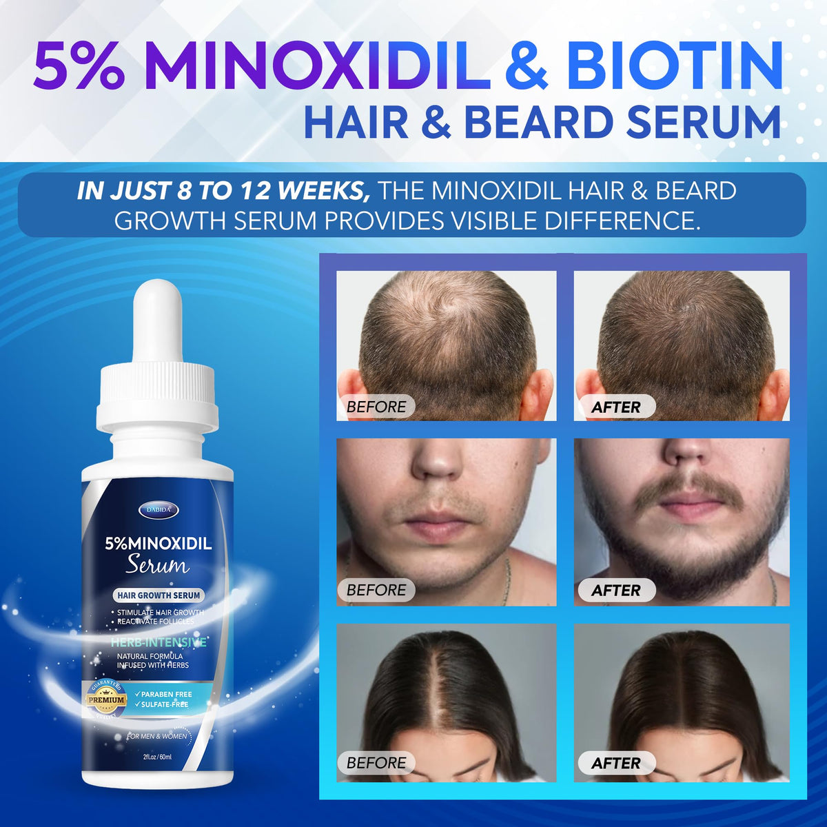 DABIDA minoxidil serum dropper dispensing precise scalp treatment