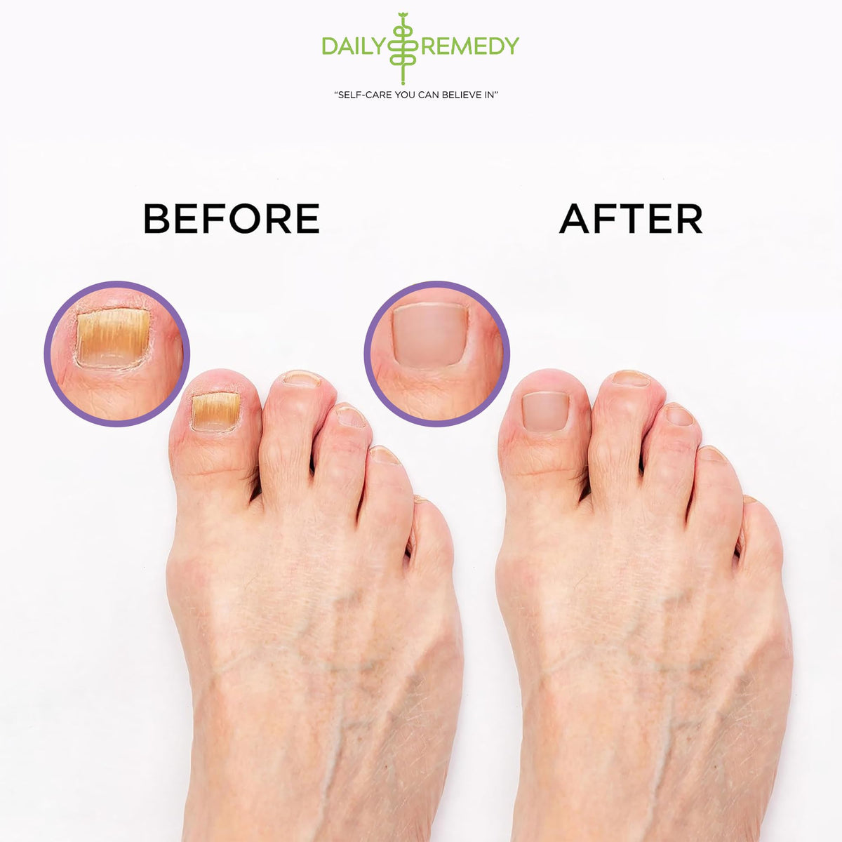 Daily Remedy Epsom Salt Foot Soak Lavender Oils for daily foot care