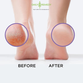 Daily Remedy Lavender Peppermint Foot Soak promotes spa-like aromatherapy
