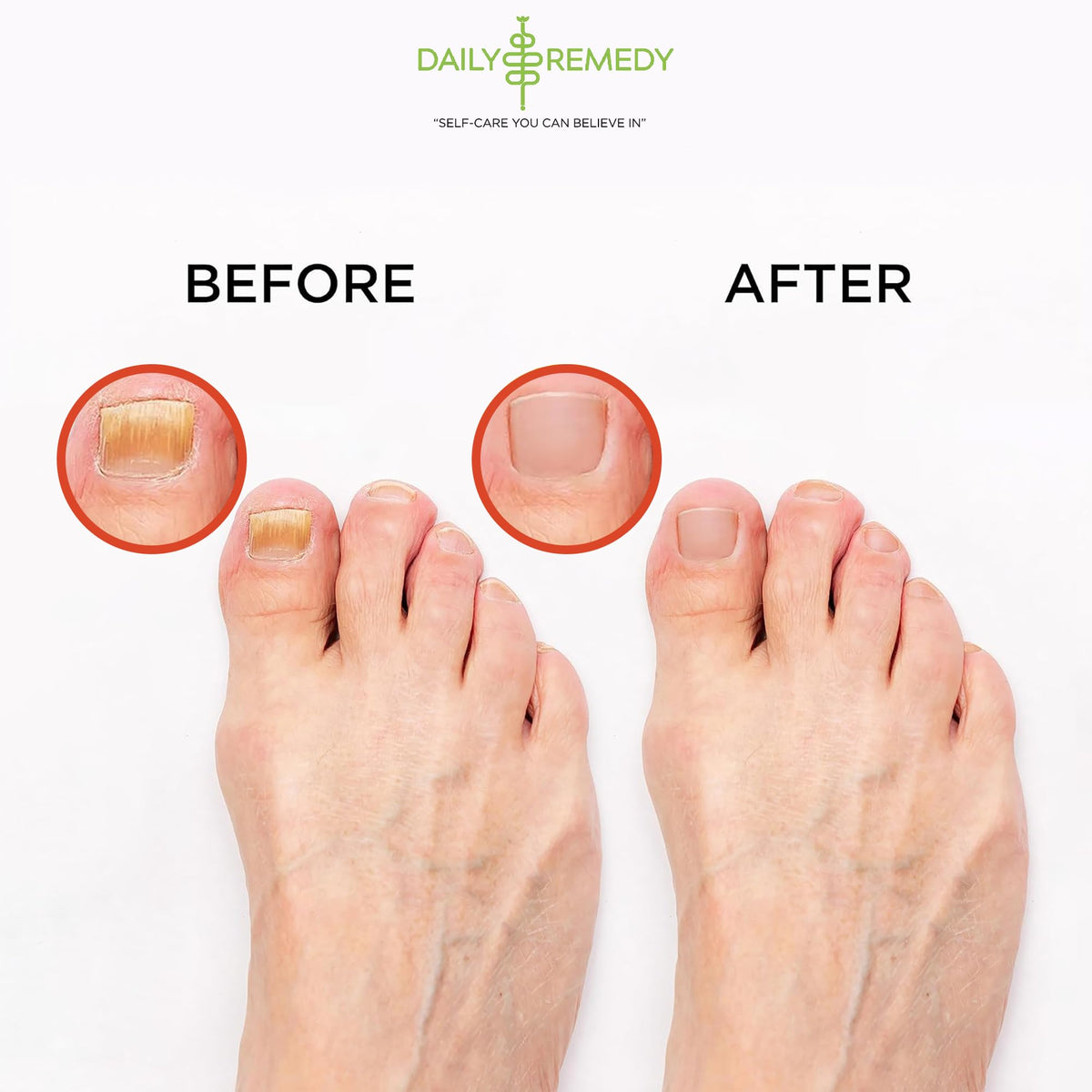 Daily Remedy foot soak pour image shows easy warm-water use.