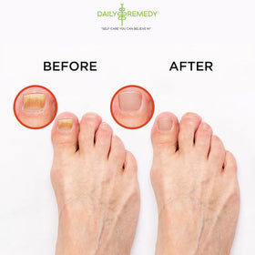 Daily Remedy foot soak pour image shows easy warm-water use.