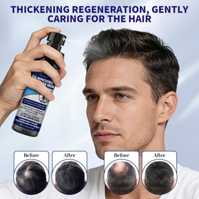 Danliss Minoxidil aids beard growth with focused facial area application