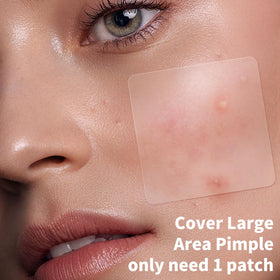 Daolyo round 12mm patch blends with skin for comfortable wear