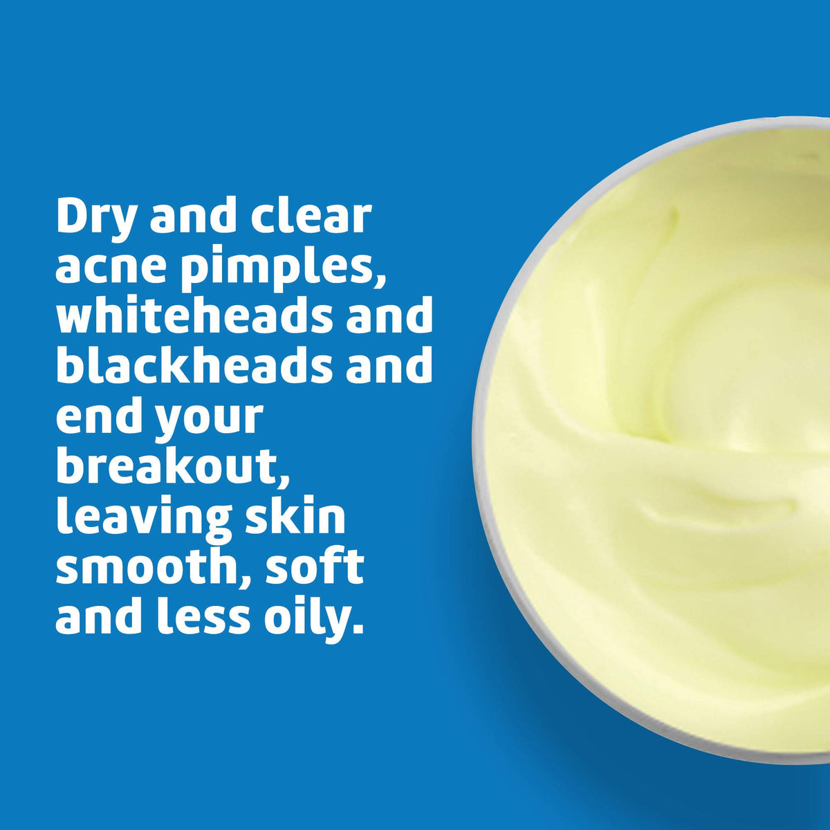 De La Cruz sulfur ointment bottle closeup and product details