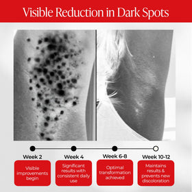 Dear Kitty inner thigh lightening action on skin for smoother appearance.