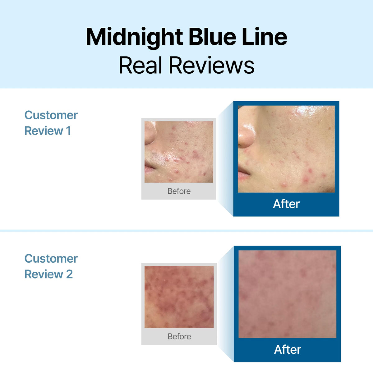 Texture swirl of DearKlairs Midnight Blue Calming Cream demonstrates light hydration.