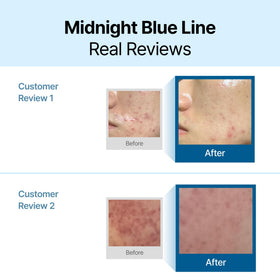 Texture swirl of DearKlairs Midnight Blue Calming Cream demonstrates light hydration.