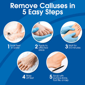 DeEnti Callus Remover feet soaking prep scene illustrating skin softening