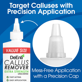 DeEnti Callus Remover gel on softened calluses detail for easier removal