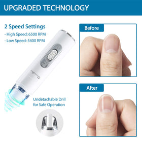 DenniesCare nail buffer kit package including all accessories.