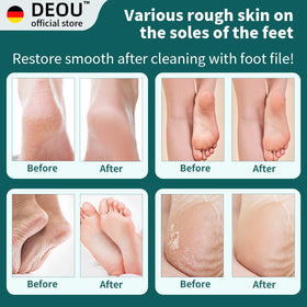 DEOU foot scrubber showing 304 stainless surface for rust-resistant cleaning