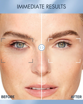 depology eye patches highlight ceramides and hyaluronic acid for moisture