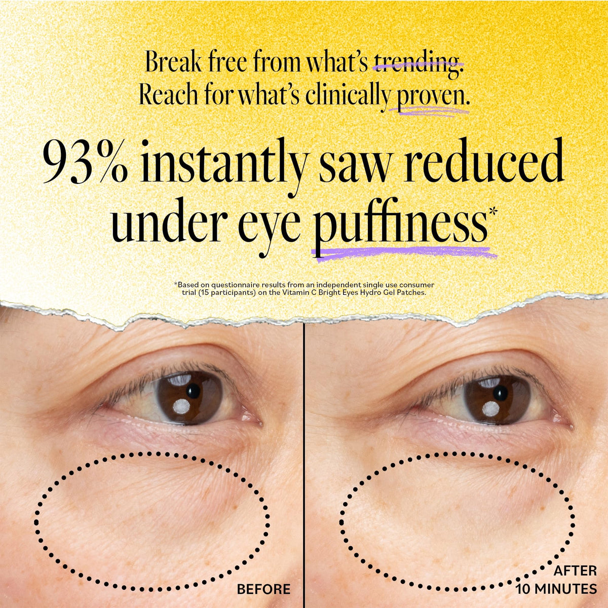 Derma E niacinamide eye brightening patches support a more even under-eye tone.