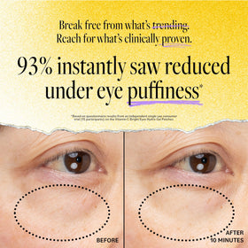 Derma E niacinamide eye brightening patches support a more even under-eye tone.