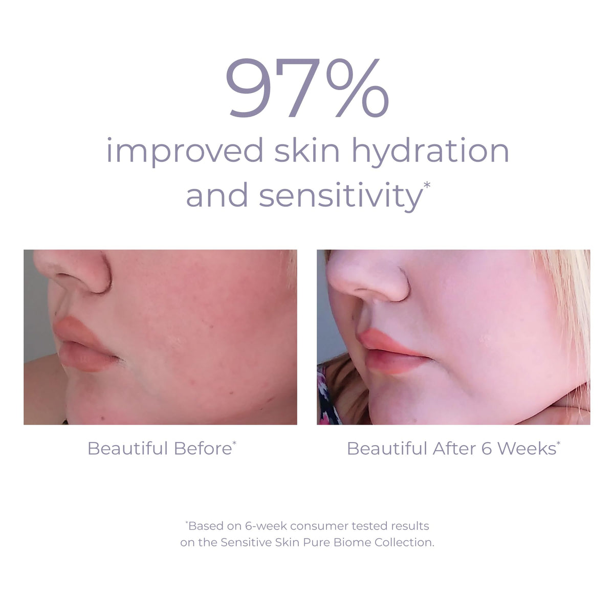 Applying Derma E Pure Biome Balancing Cream to face and neck in a routine