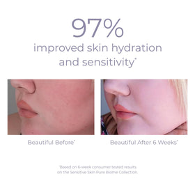 Applying Derma E Pure Biome Balancing Cream to face and neck in a routine
