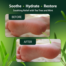 Derma-Nu oil on cracked heels, suggesting comfort and support