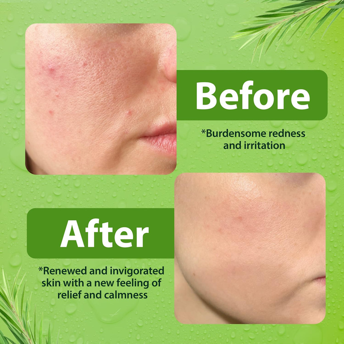 Derma-Nu Gentle Face Wash rosemary eucalyptus extracts promote oil balance.