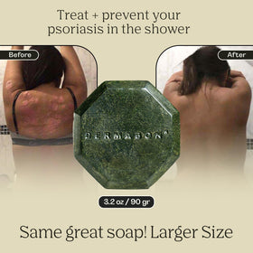 Dermabon coal tar soap bar after-use skin looks smooth and hydrated.
