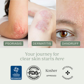 Dermabon sensitive skin routine image illustrating redness relief and calm skin.