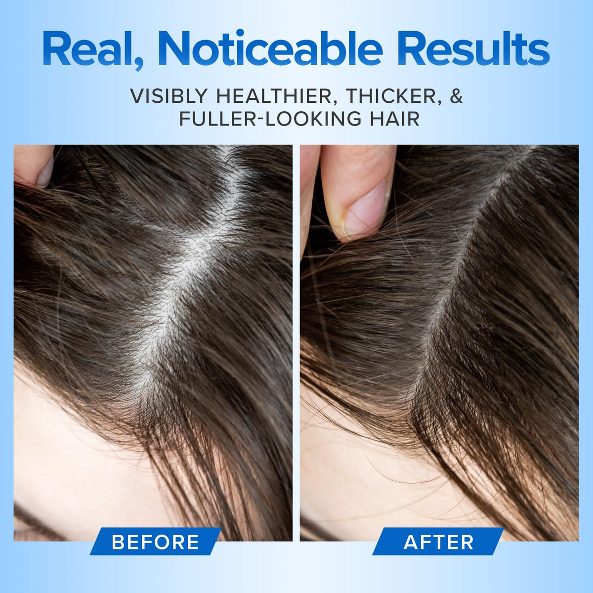 Scalp care scene with DermaChange shampoo soothing dry areas