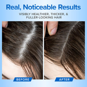 Scalp care scene with DermaChange shampoo soothing dry areas