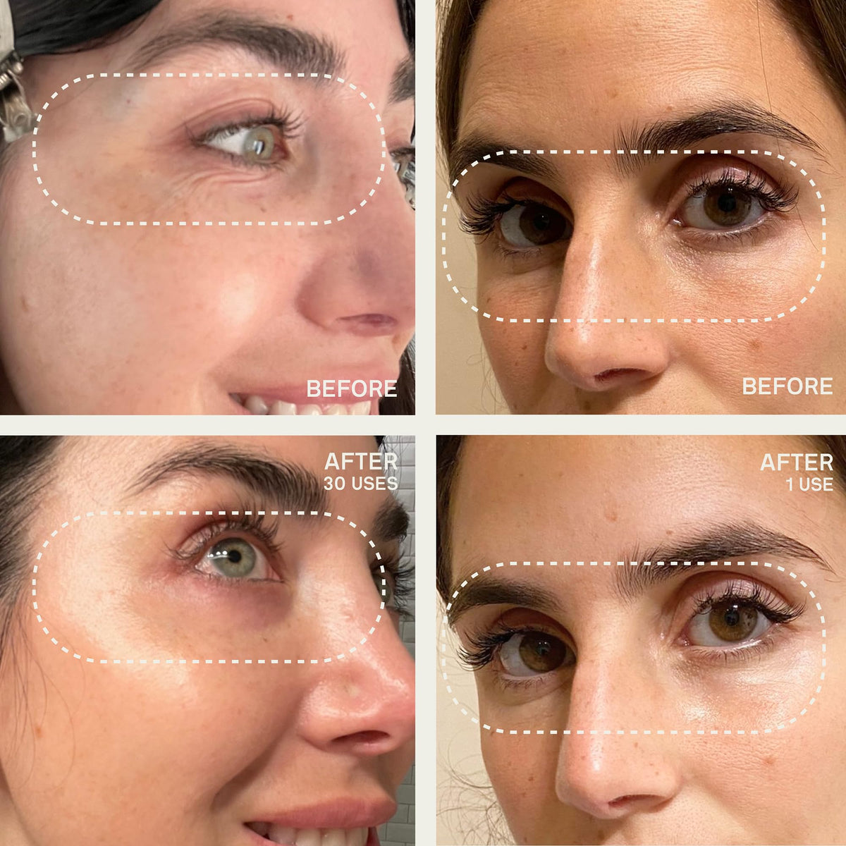 Patches worn overnight to boost moisture retention on the skin.