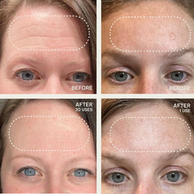 Patch Prep guidance for Dermaclara patches for best results.