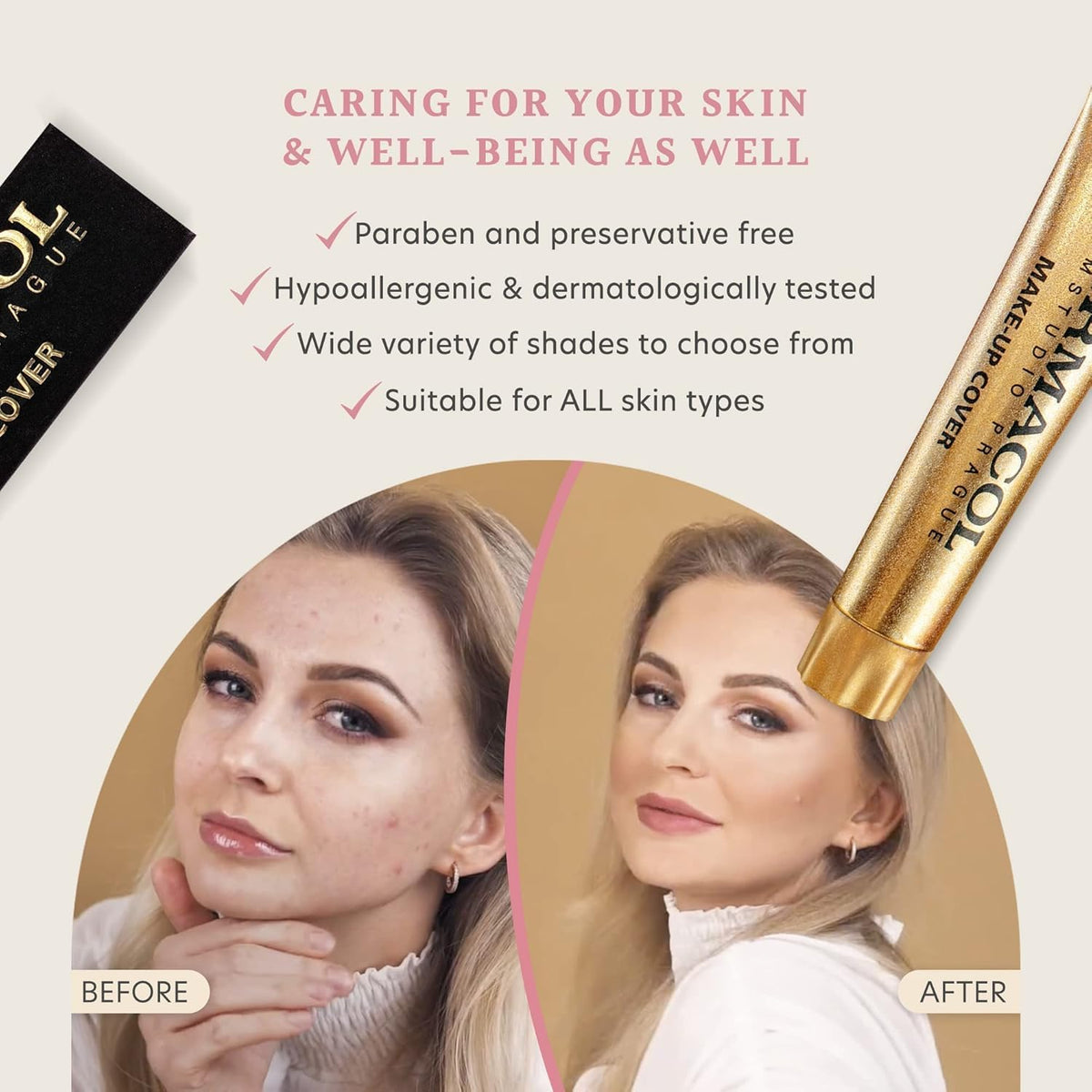 Dermacol coverage of discoloration and blemishes on realistic skin surface