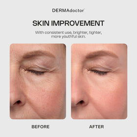 DERMAdoctor Glycolic Face Wash packaging close-up conveys premium dermatology formulation.