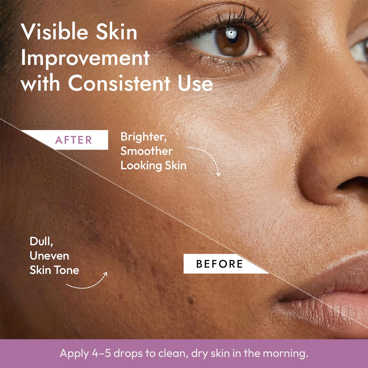 DERMADoctor serum layered under SPF or makeup for radiance.
