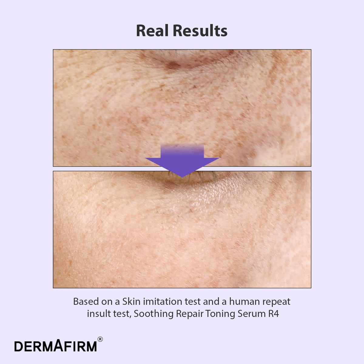 Dermafirm bottle on white background studio shot product focus